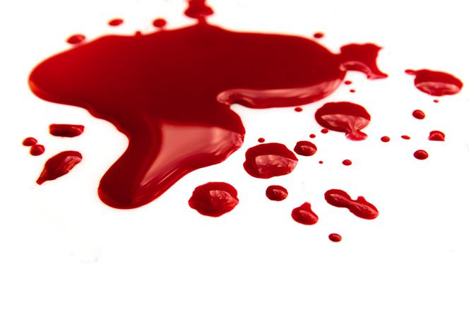 Sennik – krew. Co znaczy sen o krwi?