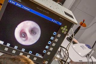 Szukali kości w gardle