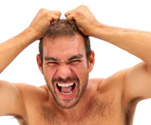 Hipertrichoza, czyli syndrom wilkołaka