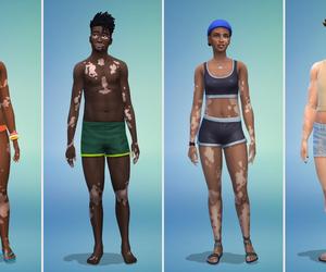 Bielactwo w The Sims 4 - zobacz, jak wyglądają simowie z nową cechą wyglądu