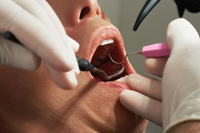 Co wyleczysz za darmo u dentysty?