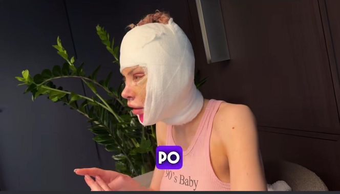 Julia Von Stein po operacji 