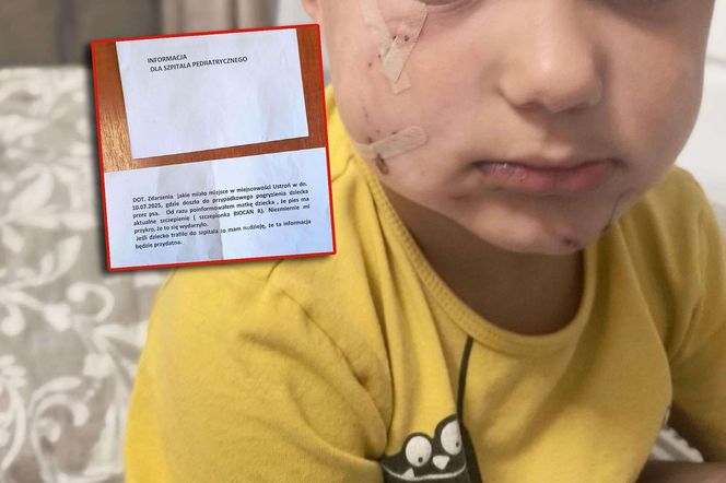 Pogryziony Franek potrzebuje pomocy. Policja szuka właściciela psa. Do szpitala dotarła anonimowa wiadomość