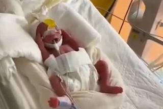 Urodziła dziewięcioraczki! Lekarze przegapili dwoje dzieci