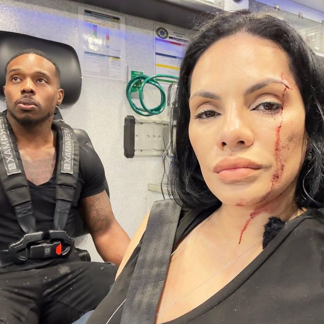 Influencerka kręciła film na Instagrama. Nagle uderzyło w nią auto!