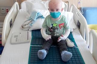 Moja skóra mnie zabija