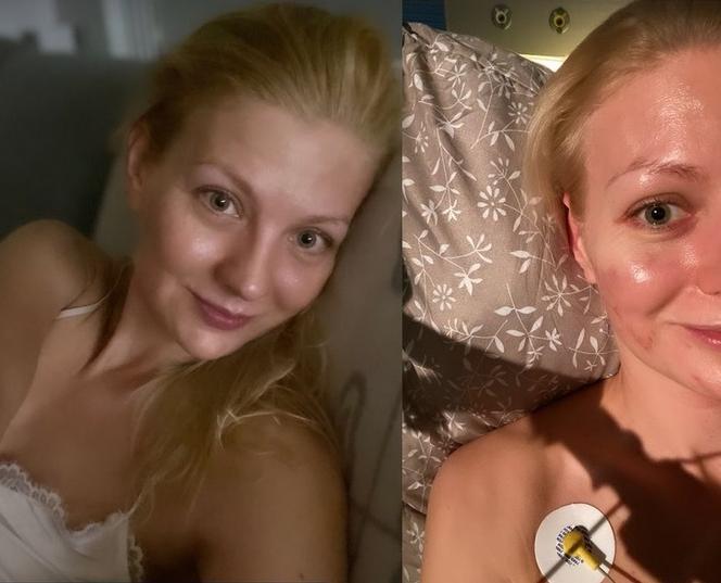 Straszny wypadek aktorki M jak miłość. Katarzyna Kołeczek trafiła do szpitala i ujawniła co się stało - ZDJĘCIA
