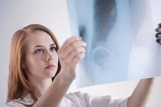 Alergiczne zapalenie pęcherzyków płucnych (AZPP) - objawy. Jak rozpoznać AZPP?