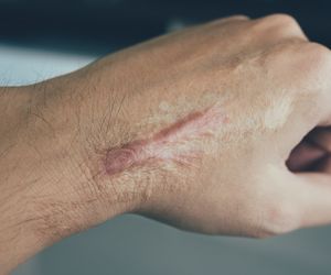 Manualna terapia blizn pooperacyjnych – na czym polega? Jak dbać o blizny?