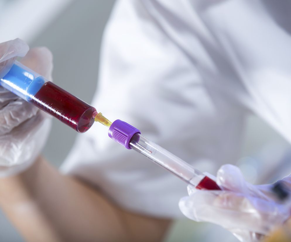 Hemoglobina  - powyżej i poniżej normy - co oznacza? Interpretacja wyników hemoglobiny w morfologii