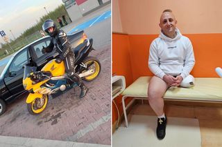 Motocyklista stracił nogę w tragicznym wypadku. Teraz zaczyna nowe życie [WIDEO, GALERIA]