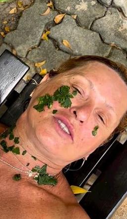 Ewa Kasprzyk poparzona przez meduzę