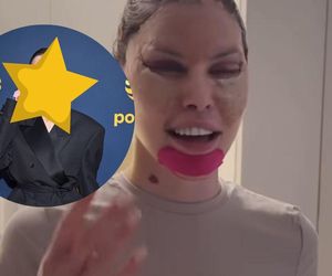 Julia von Stein ruszyła na ściankę pierwszy raz po liftingu. Było warto? Sami oceńcie [ZDJĘCIA] 