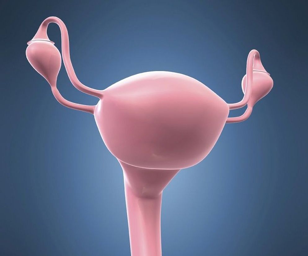 Zapalenie błony śluzowej macicy zazwyczaj jest powikłaniem po porodzie lub zabiegach diagnostycznych (np. łyżeczkowaniu, gdy nie była zachowana aseptyka). Leczenie jest konieczne, bo zapalenie śluzówki macicy może prowadzić do zapalenia przydatków (jajowodów i jajników). Jakie objawy świadczą o zapaleniu błony śluzowej macicy? Jak leczy się zapalenie śluzówki macicy?