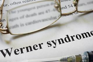 Zespół Wernera - przyczyny, objawy, diagnostyka, leczenie