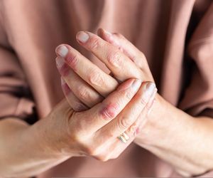 5 niepokojących zmian skórnych, które mogą być oznaką raka. Zwróć na nie uwagę