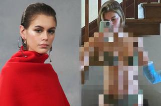 Kaia Gerber pozuje z reką w gipsie. Wy też zapatrzyliście się na coś innego?