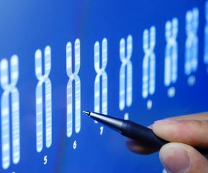 ZESPÓŁ ŁAMLIWEGO CHROMOSOMU X (FRA X) - objawy i diagnostyka zespołu FRA X