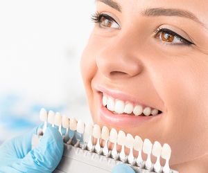 Biała dieta – co jeść po wybielaniu zębów?