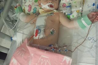 Zosia choruje na złożoną wadę serca. Potrzeba miliona złotych, by ją uratować