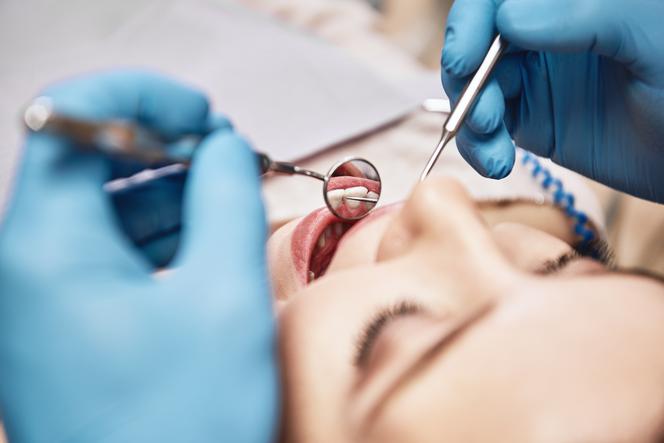 Kobieta w gabinecie stomatologicznym na wizycie kontrolnej. Lekarz stomatolog sprawdza stan wszystkich zębów. 