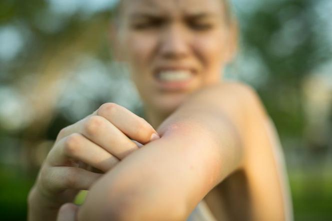 Dlaczego jednych komary gryzą bardziej niż innych?