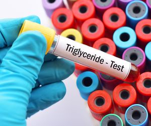 Czym są trójglicerydy? Funkcje trójglicerydów w organizmie