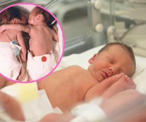  Ich więź pokonała śmierć. Te bliźniaczki zmieniły świat na zawsze. Jak wyglądają po 28 latach?