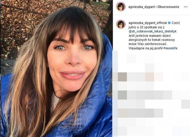 To aparat na zęby zmienił Agnieszce Dygant twarz