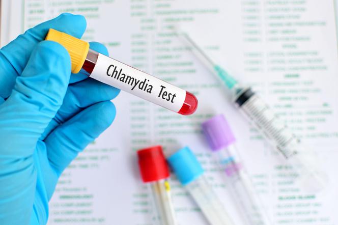 Chlamydioza - możesz się nią zarazić podczas kontaktów seksualnych