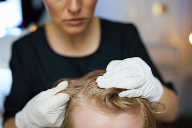 Zbliżenie na kobietę, która sprawdza, czy dziecko ma wszy we włosach 