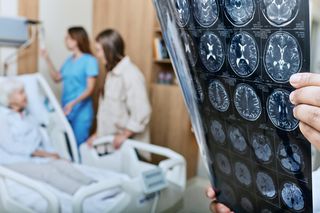 Ta dieta łagodzi przebieg alzheimera. Naukowcy pełni nadziei