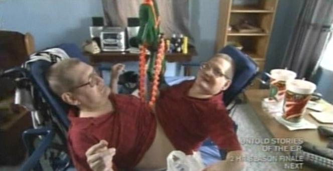 Przeżyli zrośnięci 68 lat. Nie żyją najdłużej żyjące bliźnięta syjamskie. Ronnie i Donnie Galyon