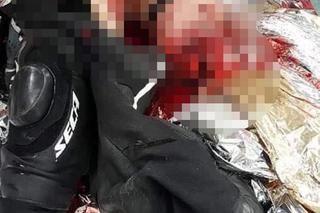 W 2019 roku stracił nogę w wypadku teraz dostał najnowocześniejszą protezę