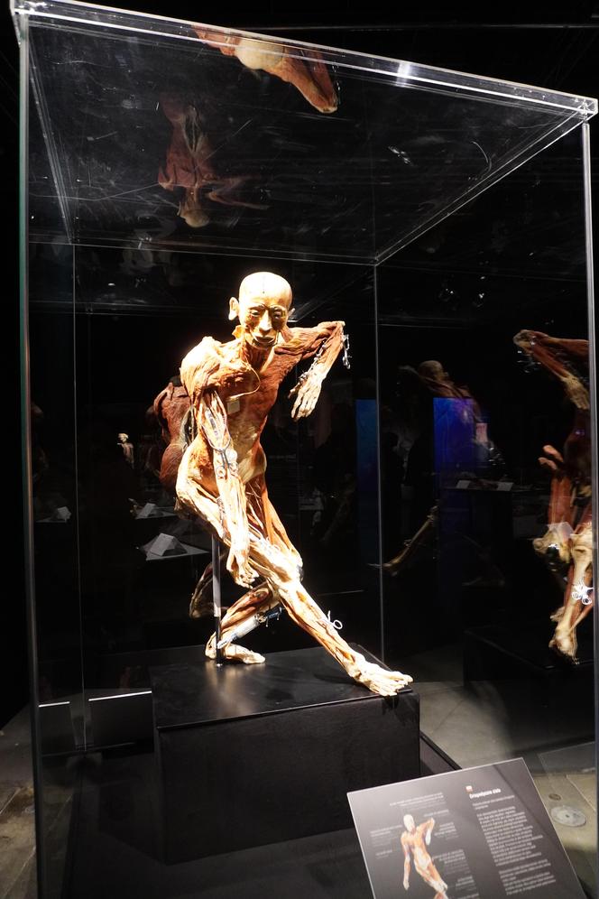 Wystawa z ludzkiego ciała. Body Worlds powróciła do Gdańska po 5 latach 