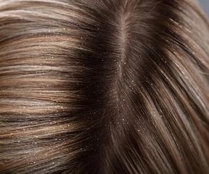 Mieszam dwie łyżki z wodą i płuczę włosy. Łupież już nie jest problemem