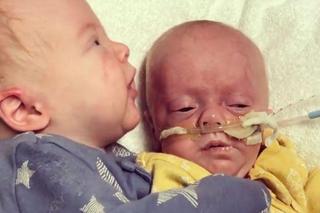 Urodził się ważąc zaledwie 0,5 kg. Silniejszy brat bliźniak pomógł mu w walce o życie