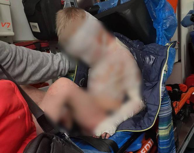 8-letni Kamilek z Częstochowy nie żyje. Lekarze od miesiąca walczyli o jego życie