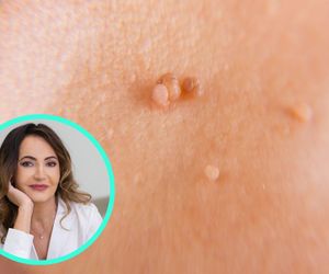 Naklej plasterek i po kłopocie? Dermatolożka ostrzega 