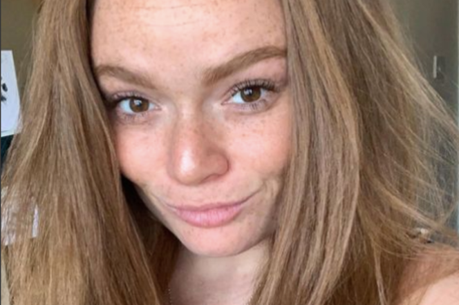 Ludzie myślą, że wciąż jest pijana. Skutki uboczne choroby „zniszczyły jej życie”