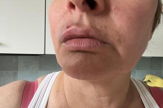 Kobieta pobita przez staruszka, bo zwróciła mu uwagę. Przewrócił mnie na chodnik i okładał parasolką, potem uderzył pięścią w twarz