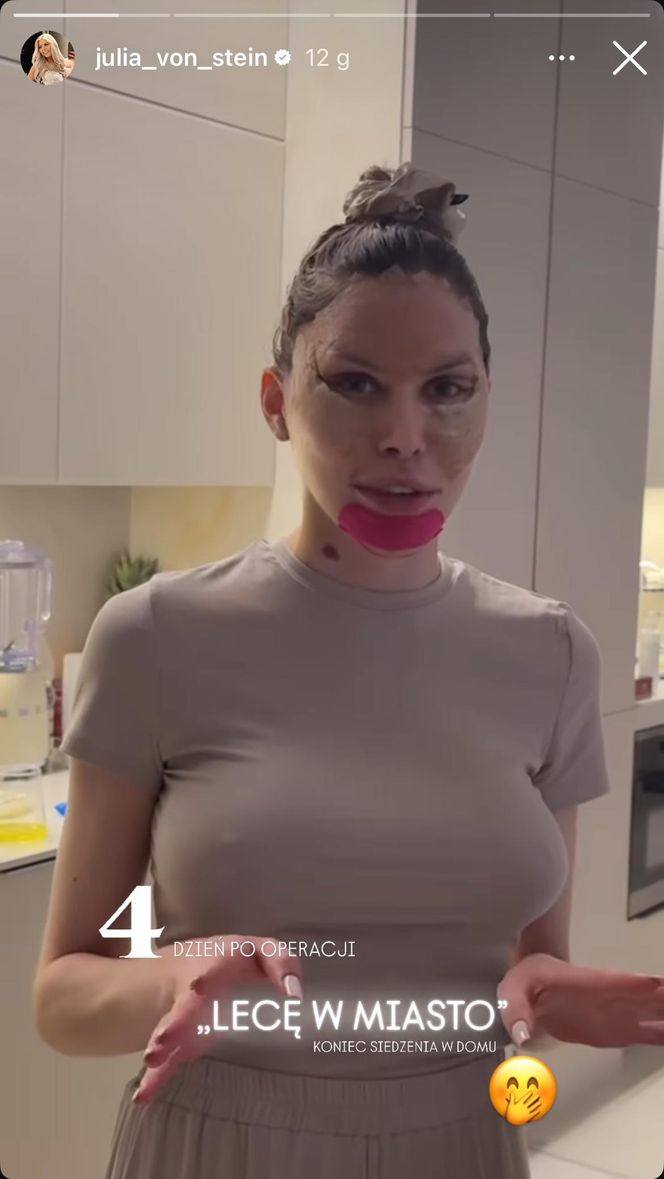 Julia von Stein po operacji