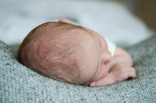 Głowa noworodka: spłaszczenie od leżenia