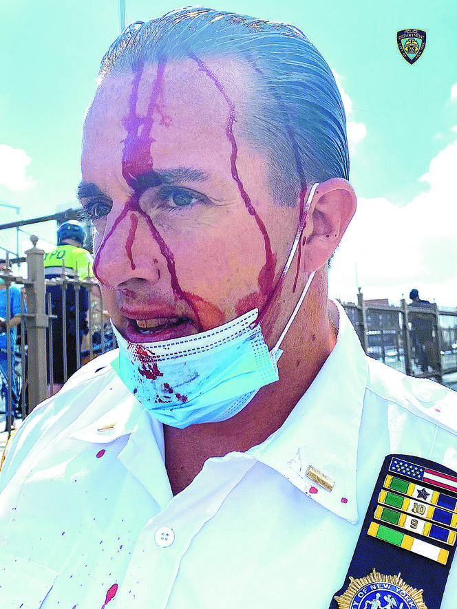 Bezbronna policja ucieka z NYC