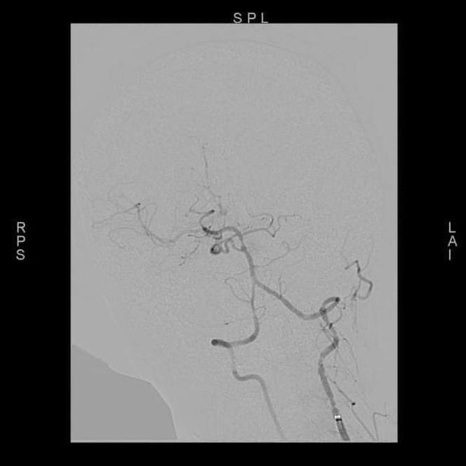 W Mazowieckim Szpitalu Specjalistycznym przeprowadzono nowatorskie zabiegi neurologiczne