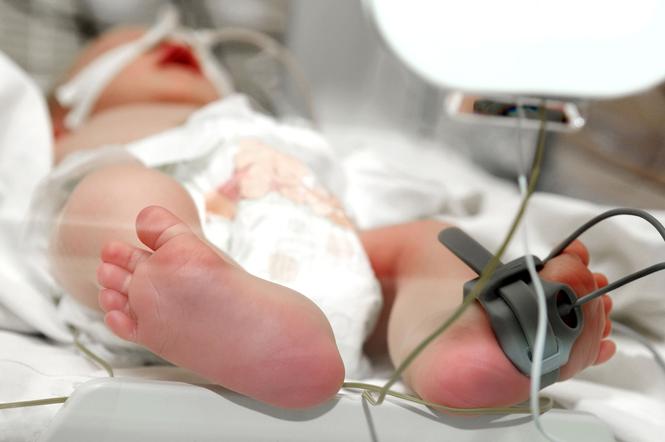 Dziecko w inkubatorze