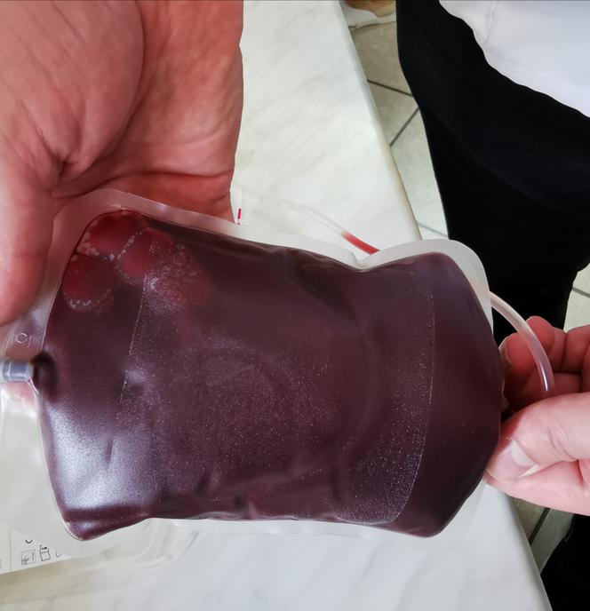 Krew - co się z nią dzieje na "trasie" od dawcy do biorcy