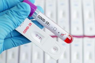 Chcesz się przebadać na covid-19? Tutaj znajdziesz testy antygenowe!