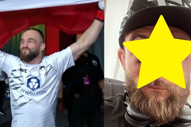 Mateusz Rębecki pokazał twarz po krwawej jatce na UFC. Szwy, opuchlizna i „jest git” [ZDJĘCIE]