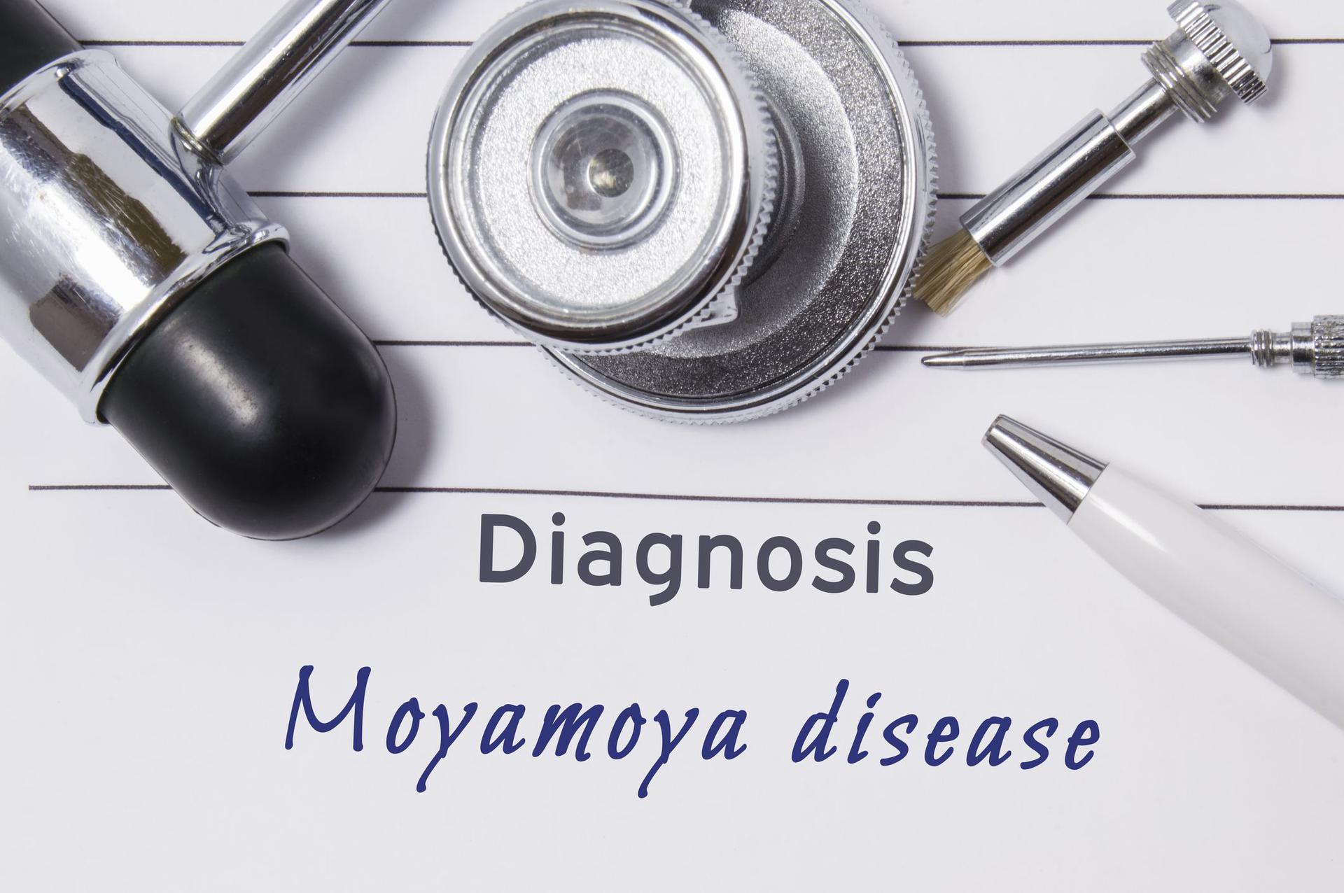 Choroba Moyamoya Przyczyny Objawy Leczenie Poradnikzdrowie Pl My Xxx Hot Girl 9767